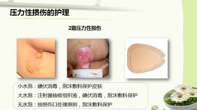 压疮最新分期与护理