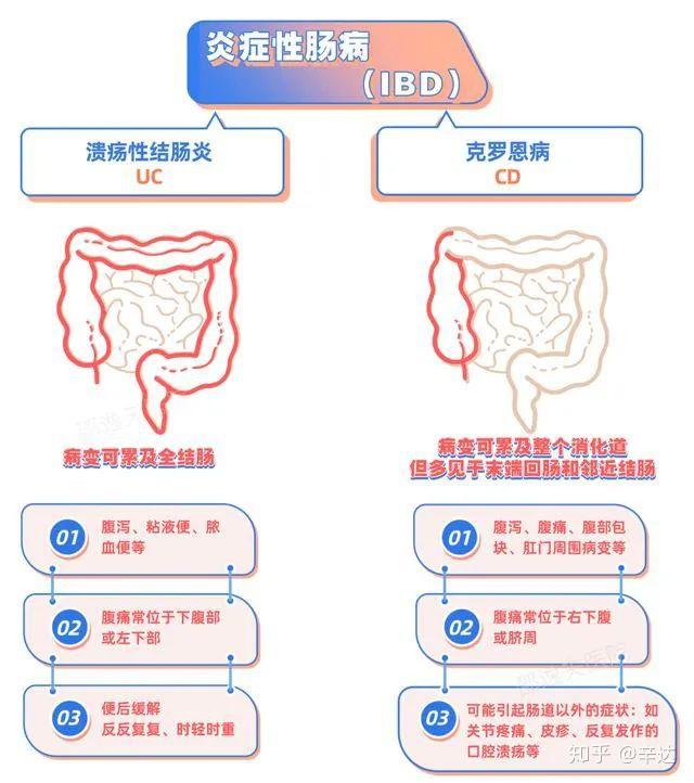 🌟最新肠炎全面解析与探讨🌟