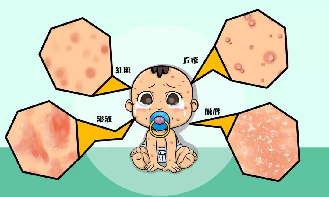 克服湿疹与自信成就感之路