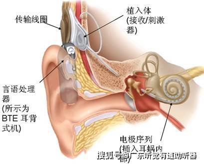 全新听觉世界门户