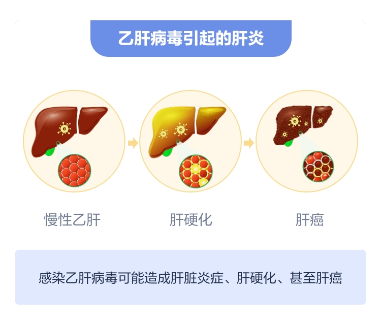 肝炎动态