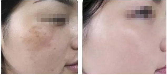 全面解析（包括价格
