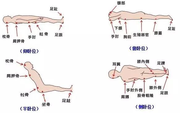 压疮最新指南，全面预防、管理与治疗策略揭秘